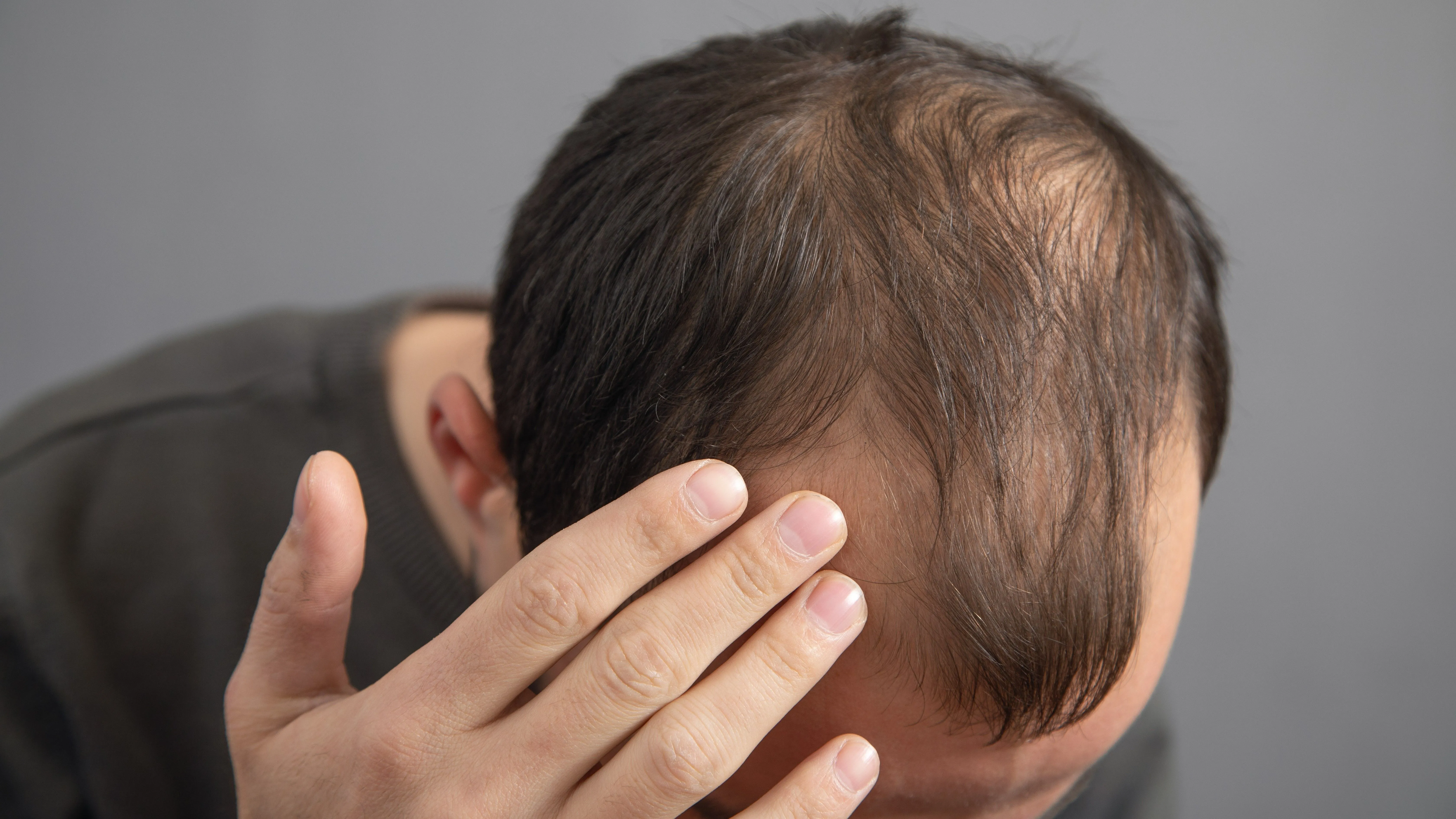 Why Do People Lose Hair And What Are The Reasons For It
